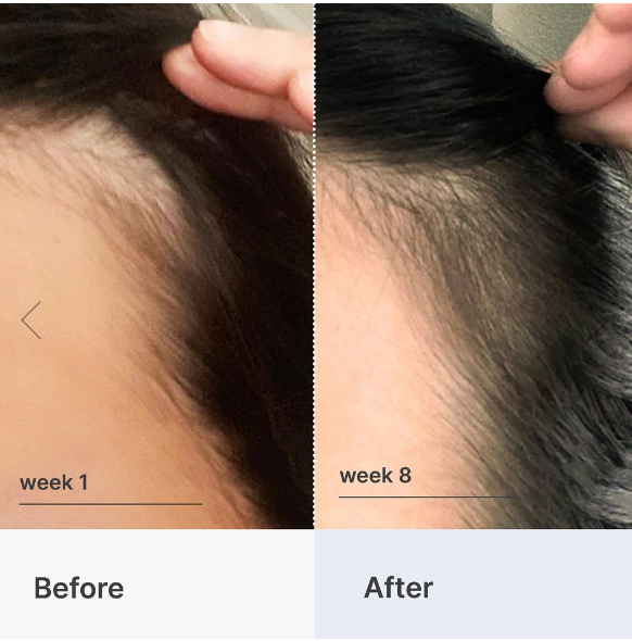 Hair Growth Serum